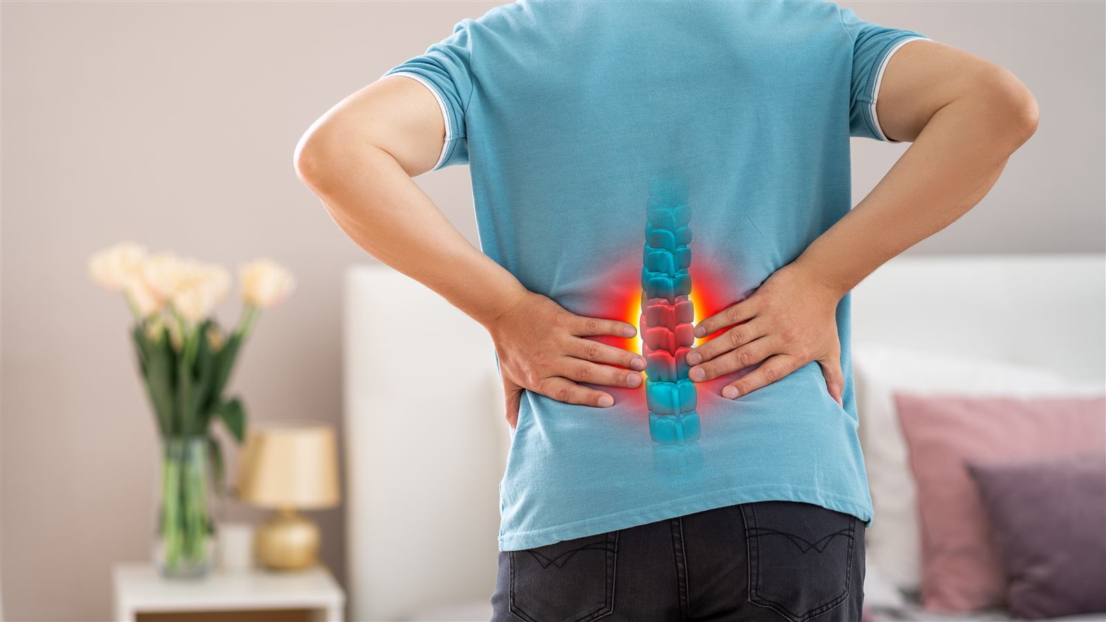 Illustration of a slipped disc (PIVD) pressing on a spinal nerve