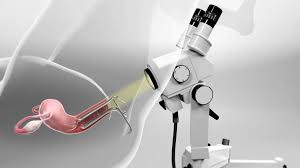 Colposcopy at Purva Hospital