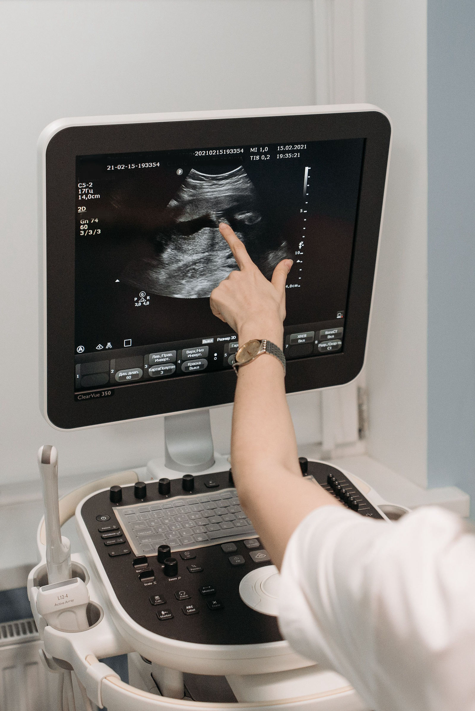 Ultrasound sonography at Purva Hospital